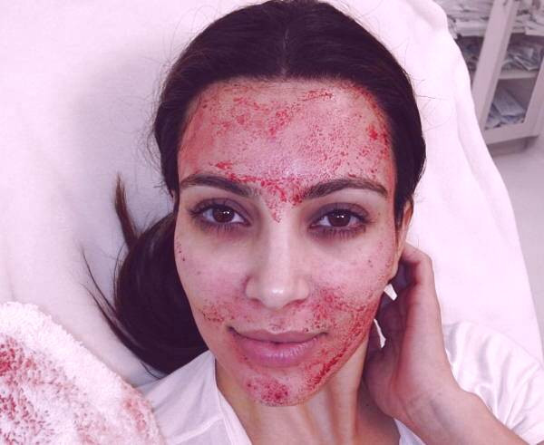 پوست کیم کارداشیان