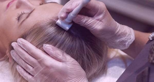 میکرونیدلینگ سر