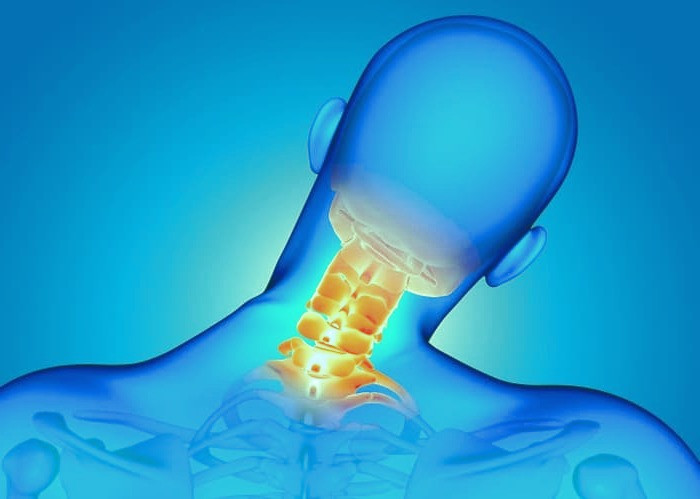 علل اسپوندیلوز گردن 