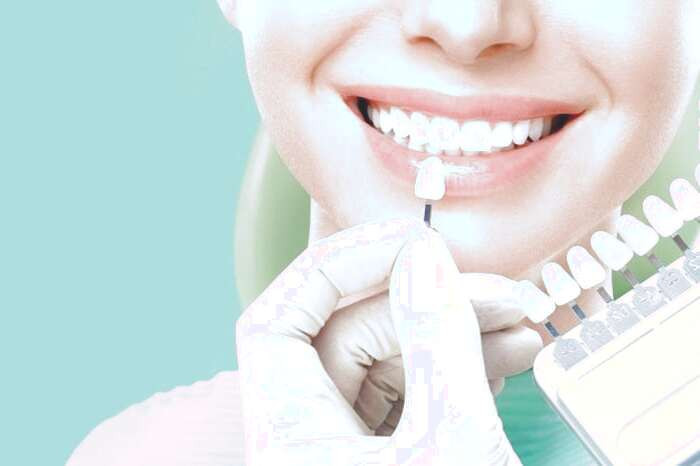 چگونه لامینیت از دندان جدا میشود لامینیت