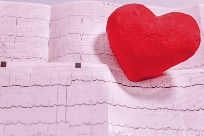 مشکلات قلبی افراد مبتلا به سندرم داون مشکلات قلبی