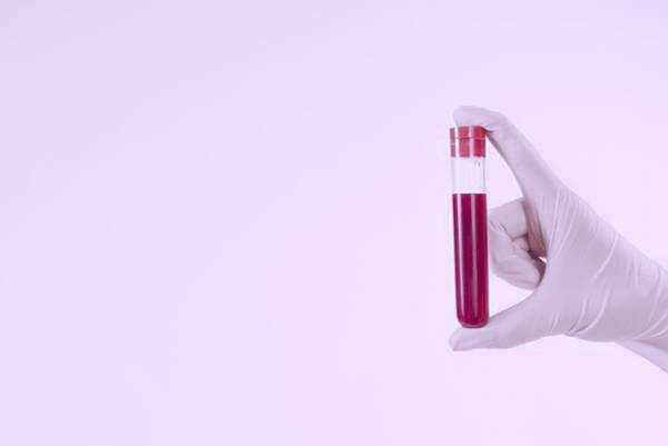 آزمایش چربی