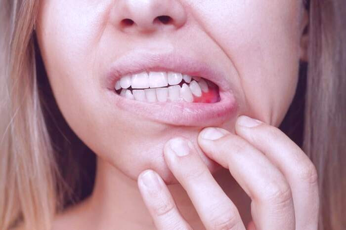 مسواک زدن بیش از حد