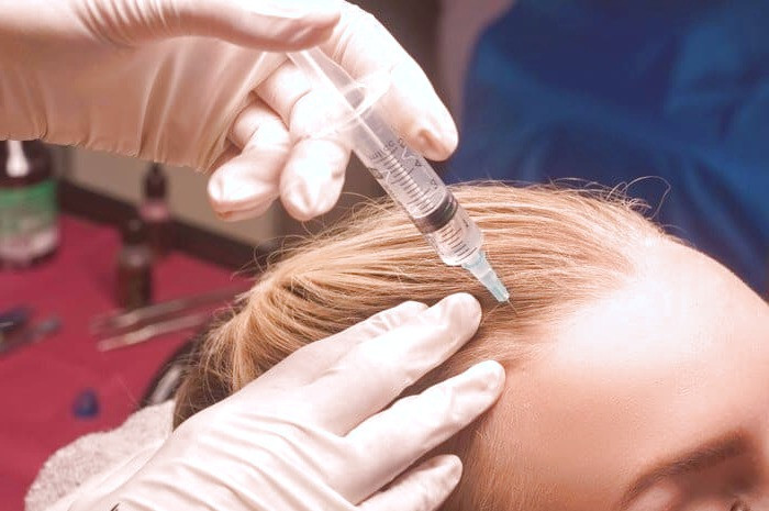 مضرات بوتاکس مو