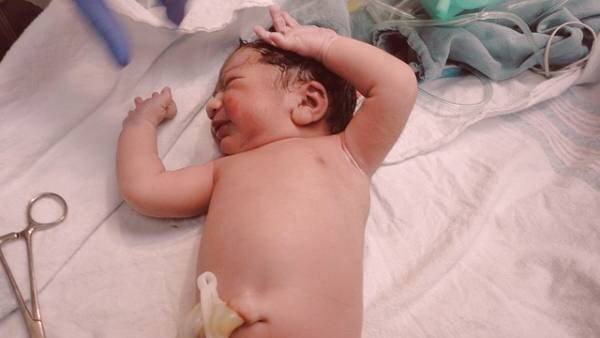 نکات خون بند ناف