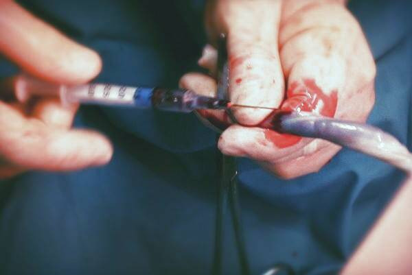 درمان با خون بند ناف