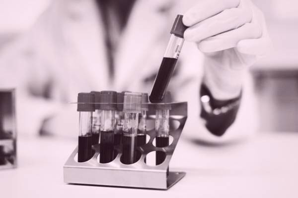 پایین بودن هورمون پرولاکتین