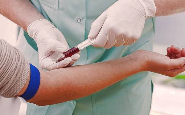 آزمایش پرولاکتین