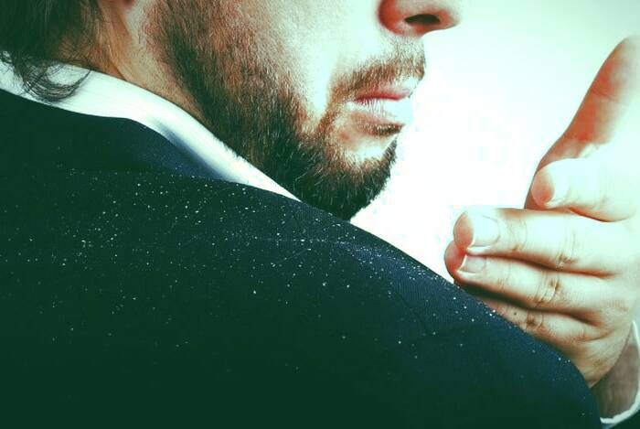 عوامل شوره سر