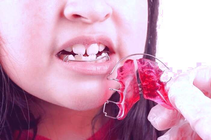 بهترین زمان ارتودنسی