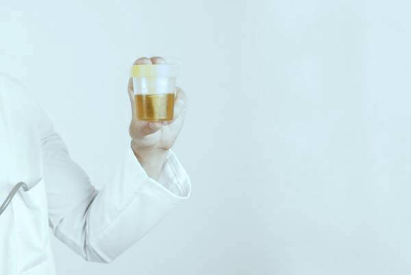 عوارض التهاب مثانه نمونه برداری از ادرار