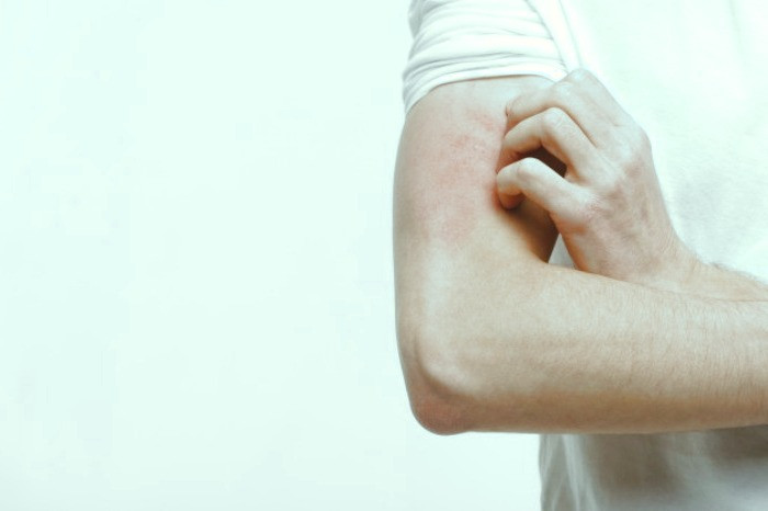 حساسیت های استفاده از مام و اسپری زیر بغل خارش پوست