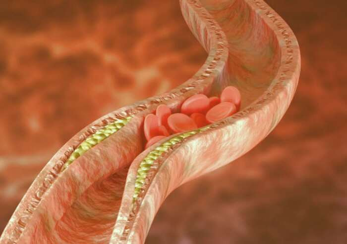 کاهش کلسترول