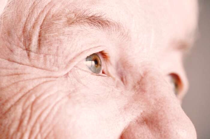 افزایش سن از عوامل سوزش چشم افزایش سن و چشم