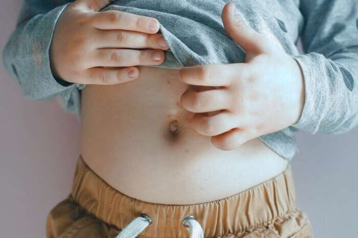 علت آکنه روی شکم جوش شکم