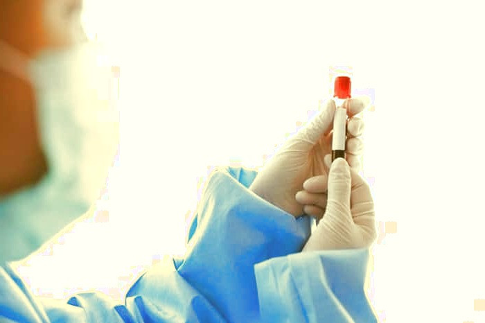 درمان پلاکت خون پایین با رژیم غذایی رژیم غذایی افزایش پلاکت خون