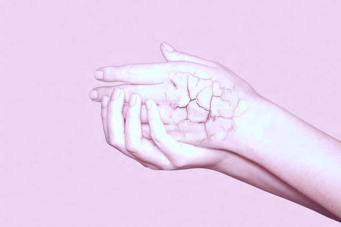 بیماری پوستی