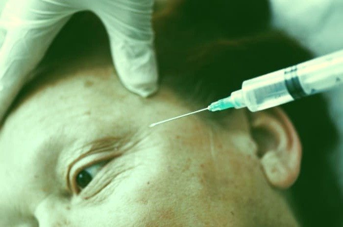 رفع عوارض بوتاکس