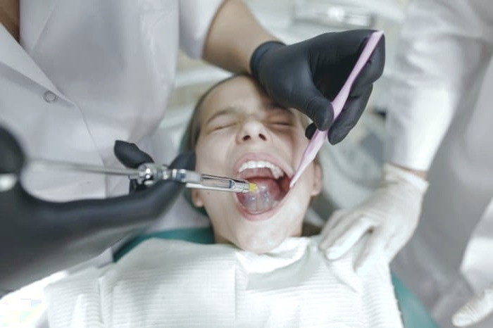 زمان کشیدن دندان شیری دندان شیری