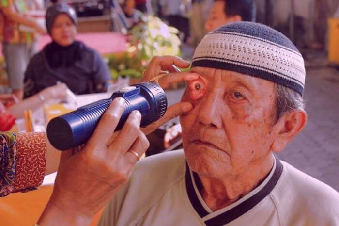 تشخیص آلزایمر