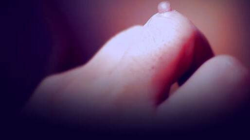 زگیل کودکان