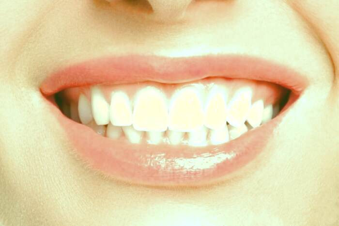 لیزر برای لثه