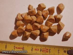 علائم سنگ کیسه صفرا: آنچه باید بدانید