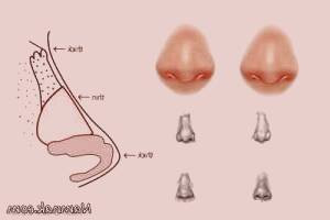 بررسی تفاوت های بینی های گوشتی و انواع مختلف آن