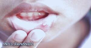 زخم های دهان سرطانی: شناسایی و مدیریت