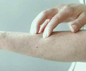 بهترین راه برای رفع سلولیت