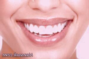 دندان با استفاده نامناسب از ترکیبات دندانی