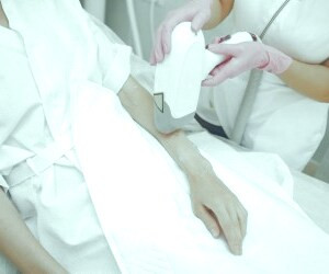 بهبود نتایج لیزر موهای زائد: عوامل کلیدی