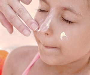 بهترین راهکارهای طبیعی برای پیشگیری و درمان آفتاب سوختگی