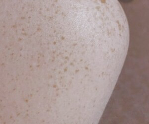 بهترین روش های درمان لکه های پوست پا در خانه