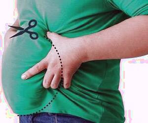 لاغری موضعی و غیر تهاجمی با دستگاه لاغری