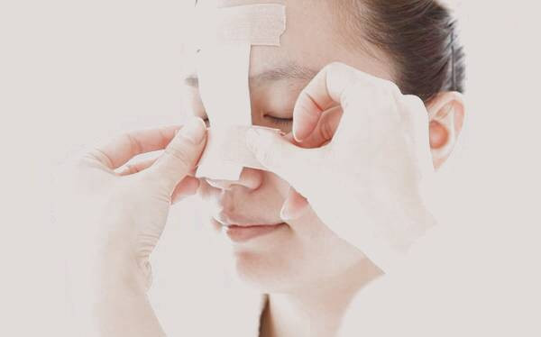 مدت زمان چسب زدن بعد از عمل بینی