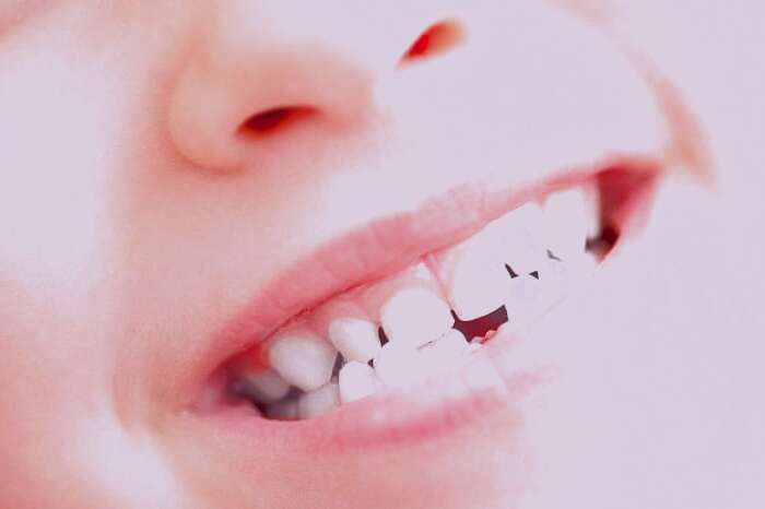 دندان دائمی