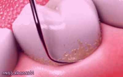 آیا جرمگیری خطرناک است