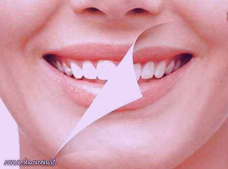 جرمگیری چیست و چه ضررهایی دارد