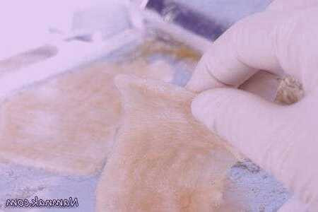 ژل متوقف کننده خونریزی