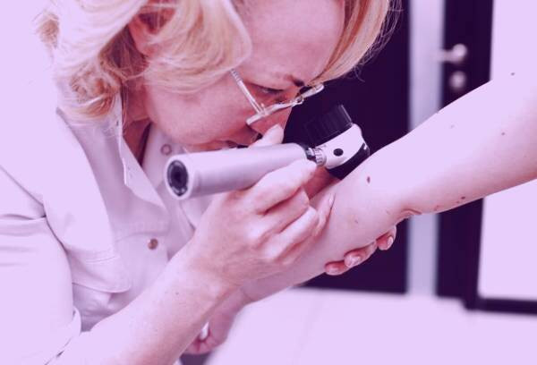 علائم ملانوما