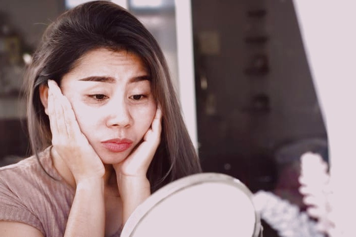 روش بوتاکس پیشانی