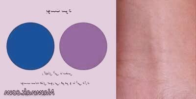رنگ پوست