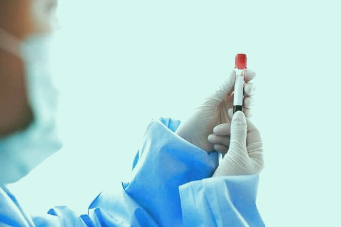 کمبود ویتامین k