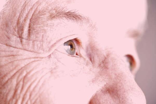 چروک دور چشم