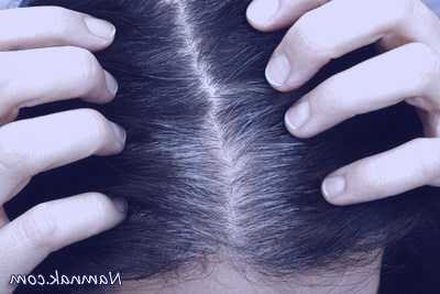 سفید شدن زودرس موها