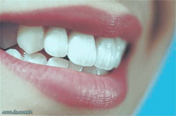 کامپوزیت دندان