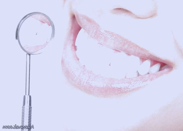 کامپوزیت دندان