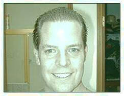 کاشت و موی سر در کلینیک معتبر با تصاویر