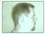 کاشت و موی سر در کلینیک معتبر با تصاویر